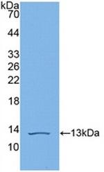 Complement C4b Antibody in Western Blot (WB)