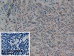 C1QBP Antibody in Immunohistochemistry (Paraffin) (IHC (P))