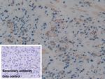 C1QBP Antibody in Immunohistochemistry (Paraffin) (IHC (P))