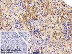 C1QBP Antibody in Immunohistochemistry (Paraffin) (IHC (P))