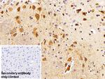 C1QBP Antibody in Immunohistochemistry (Paraffin) (IHC (P))