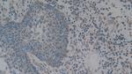 C1QBP Antibody in Immunohistochemistry (Paraffin) (IHC (P))