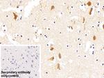 C1QBP Antibody in Immunohistochemistry (Paraffin) (IHC (P))
