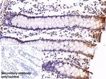 C1QBP Antibody in Immunohistochemistry (Paraffin) (IHC (P))