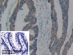 C1QBP Antibody in Immunohistochemistry (Paraffin) (IHC (P))