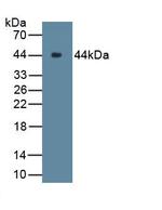 Complement C9 Antibody in Western Blot (WB)