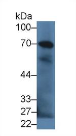 Complement C9 Antibody in Western Blot (WB)