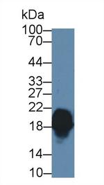 CPLX1 Polyclonal Antibody