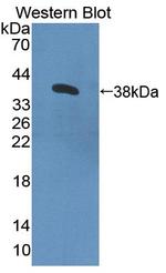 CNTN4 Antibody in Western Blot (WB)