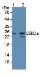 CBF beta Antibody in Western Blot (WB)