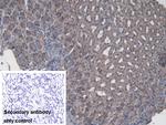 CBF beta Polyclonal Antibody