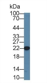 CBF beta Antibody in Western Blot (WB)
