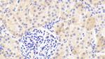 SERPINA6 Polyclonal Antibody