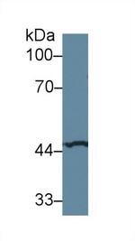 SERPINA6 Antibody in Western Blot (WB)