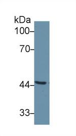 SERPINA6 Antibody in Western Blot (WB)