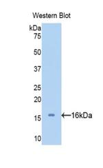 SERPINA6 Antibody in Western Blot (WB)