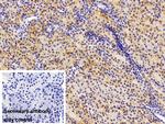 beta L Crystallin Antibody in Immunohistochemistry (Paraffin) (IHC (P))