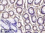 beta L Crystallin Antibody in Immunohistochemistry (Paraffin) (IHC (P))