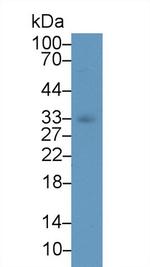 beta L Crystallin Antibody in Western Blot (WB)