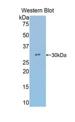 beta L Crystallin Antibody in Western Blot (WB)