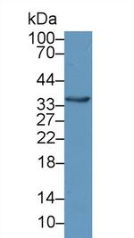 beta L Crystallin Antibody in Western Blot (WB)