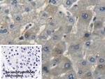 CNP Polyclonal Antibody