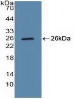 Cyclin B1 Antibody in Western Blot (WB)