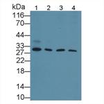 Cyclin D1 Antibody in Western Blot (WB)