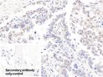 CDK4 Antibody in Immunohistochemistry (Paraffin) (IHC (P))