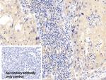 CDK4 Antibody in Immunohistochemistry (Paraffin) (IHC (P))