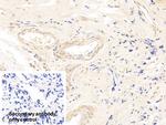 CDK4 Polyclonal Antibody