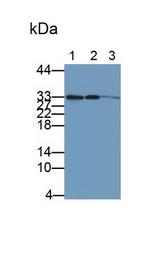 CDK4 Antibody in Western Blot (WB)