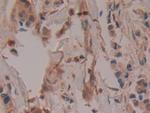 COX2 Antibody in Immunohistochemistry (Paraffin) (IHC (P))