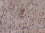 COX2 Polyclonal Antibody