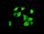 Cyclophilin 40 Antibody in Immunocytochemistry (ICC/IF)