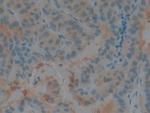 Cystatin B Antibody in Immunohistochemistry (Paraffin) (IHC (P))