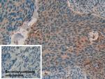 Cystatin B Antibody in Immunohistochemistry (Paraffin) (IHC (P))