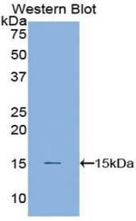 Cystatin B Antibody in Western Blot (WB)