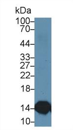 Cystatin B Antibody in Western Blot (WB)