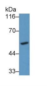 CYP26A1 Antibody in Western Blot (WB)