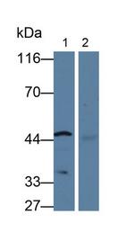 CYP26A1 Antibody in Western Blot (WB)