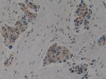 Cytokeratin 1 Antibody in Immunohistochemistry (Paraffin) (IHC (P))