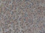 Cytokeratin 1 Antibody in Immunohistochemistry (Paraffin) (IHC (P))
