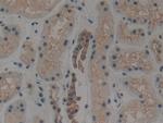 Cytokeratin 1 Antibody in Immunohistochemistry (Paraffin) (IHC (P))