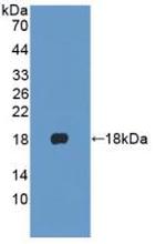 Cytokeratin 1 Antibody in Western Blot (WB)