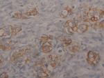 Cytokeratin 18 Antibody in Immunohistochemistry (Paraffin) (IHC (P))