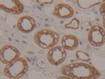 Cytokeratin 18 Antibody in Immunohistochemistry (Paraffin) (IHC (P))