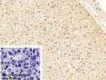 Cytokeratin 18 Antibody in Immunohistochemistry (Paraffin) (IHC (P))