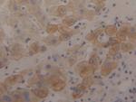 Cytokeratin 18 Antibody in Immunohistochemistry (Paraffin) (IHC (P))
