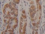 Cytokeratin 18 Antibody in Immunohistochemistry (Paraffin) (IHC (P))